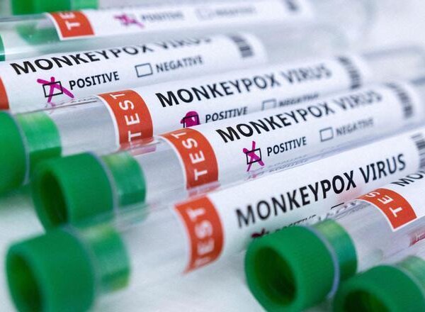 La OMS cambia el nombre de la viruela del mono por ‘mpox’