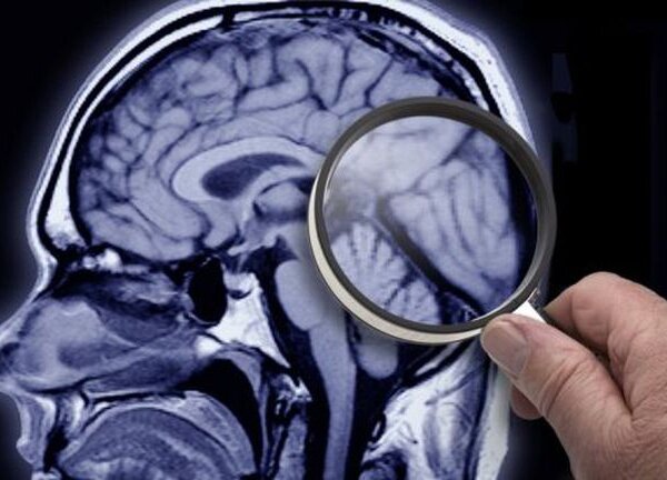 El “cerebro cuántico”, la misteriosa teoría que devela porqué tenemos y cómo surge nuestra conciencia