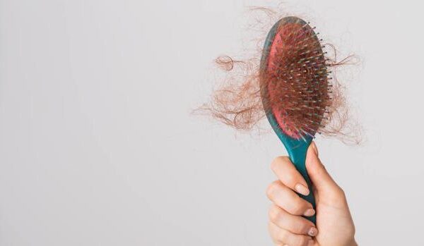 Alopecia: cinco aspectos que influyen en la caída del pelo y no lo sabes