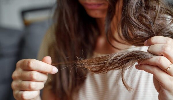 Por qué se les cae tanto el pelo a algunas mujeres jóvenes