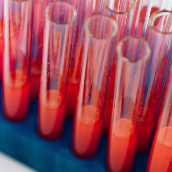 Un nuevo test para detectar el cáncer de próstata