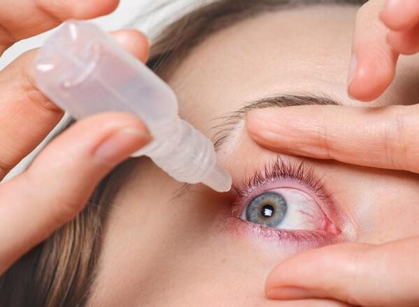 Alergia primaveral, ¿cómo afecta a nuestros ojos?